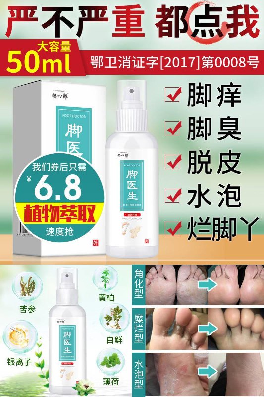 杨四郎！止痒抑菌脚气喷剂50ml券后【6.8元】包邮秒杀